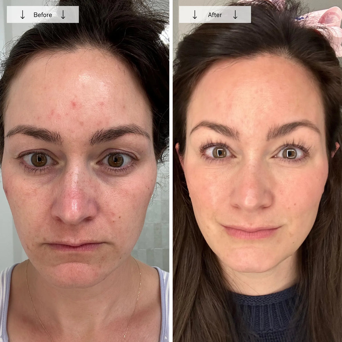 Contour LED Light Therapy Face Mask
