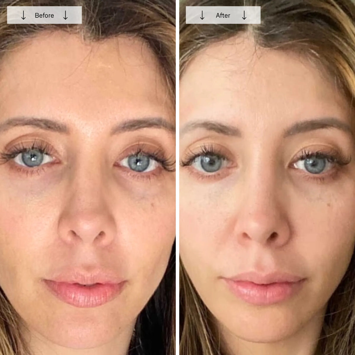 Contour LED Light Therapy Face Mask