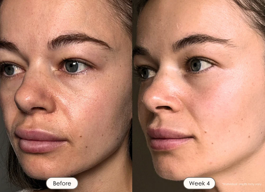 Dull Skin, Early Signs of Aging