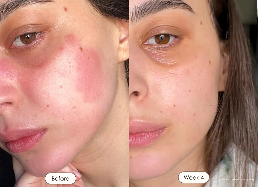 Balanced skin tone