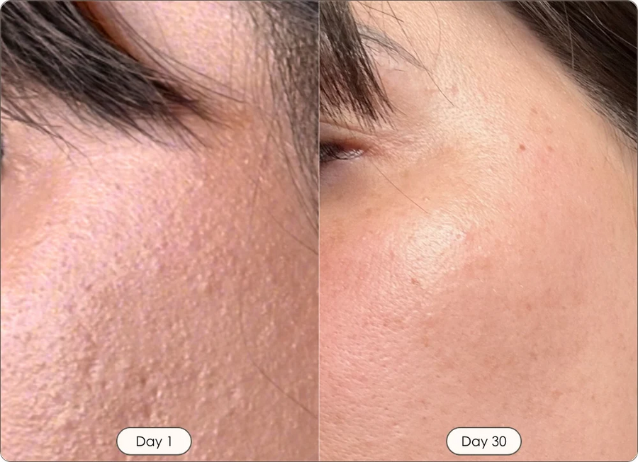 Skin Texture, Fine Lines